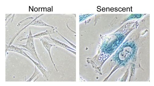 normal vs senescent cell